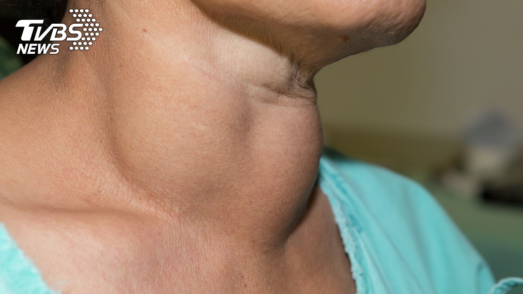 若出現腫塊，很有可能是身體發出警訊。示意圖／TVBS 脖子和耳後長腫塊？　別輕忽身體發出的「4大警訊」