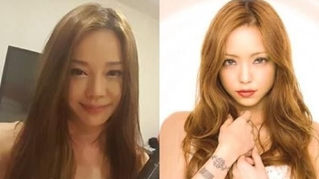 診所貼出狄鶯(圖左)和日本天后安室奈美惠的對比照。(圖/翻攝自醫美診所官網)