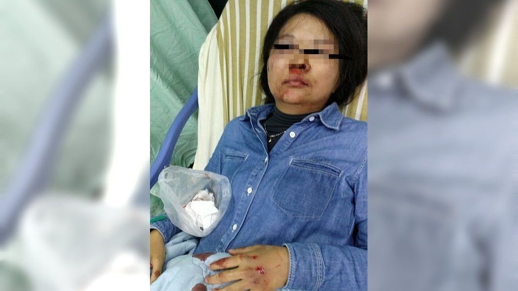 男網友希望政府機關積極重視流浪狗議題,並且呼籲民眾不要隨意餵養路邊流浪狗。圖/翻攝自臉書「爆料公社」