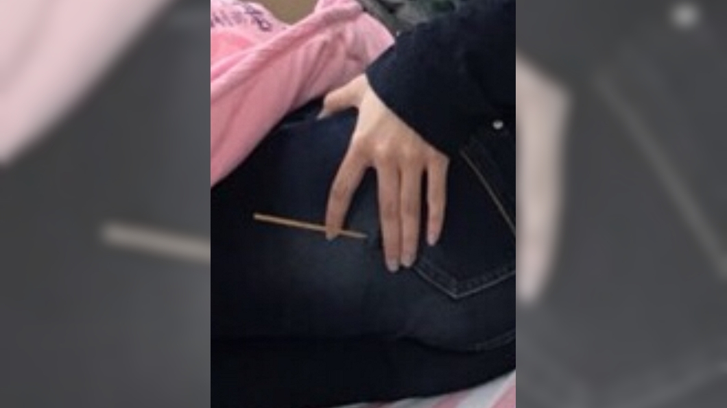 一名女網友不慎被竹籤插進屁股裡。圖/翻攝自Dcard