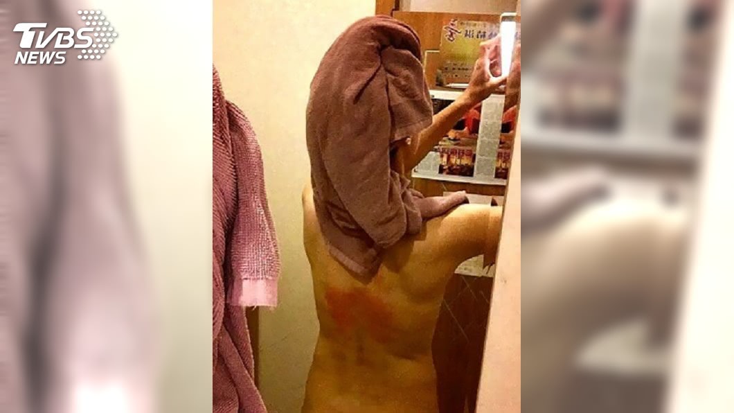 竹科一名女子日前做岩盤浴被燙傷，憤而對店家提告求償。(圖／中央社，TVBS)
