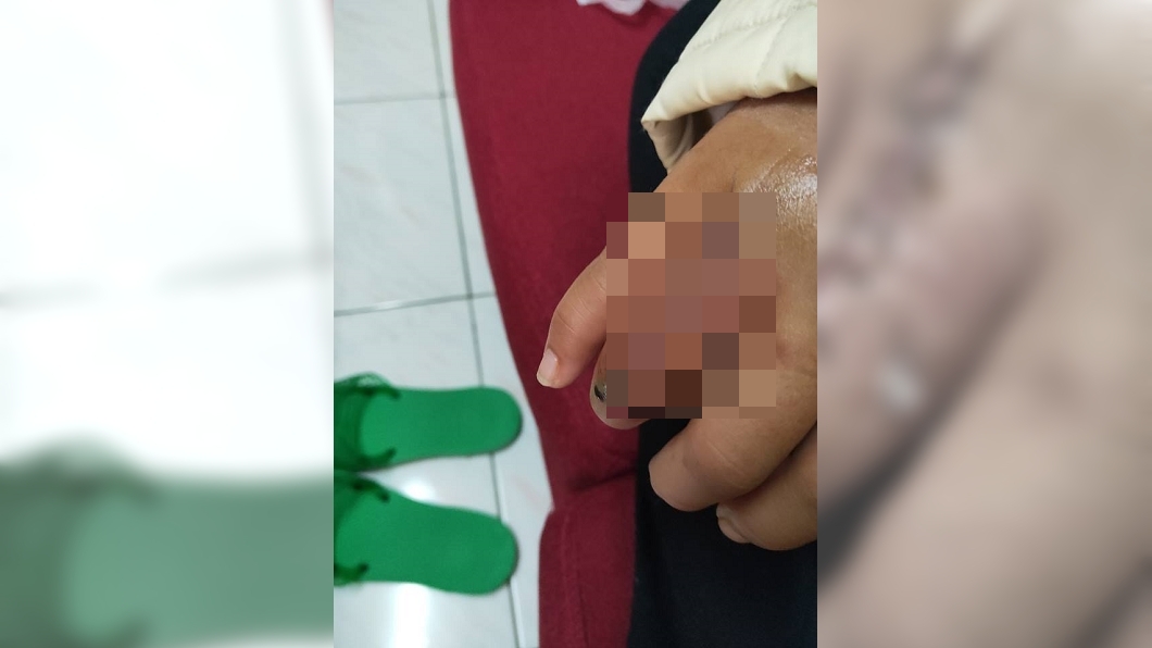 高雄一名女子只因沒帶鑰匙遭男友暴打。圖/翻攝自爆料公社