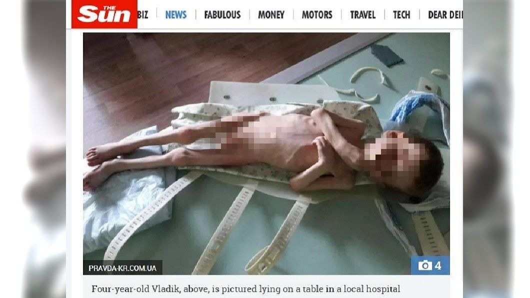 烏克蘭一名4歲的男童，被父親認為是小王的種，遭到狠狠虐待瘦到剩皮包骨。(圖／翻攝自太陽報)