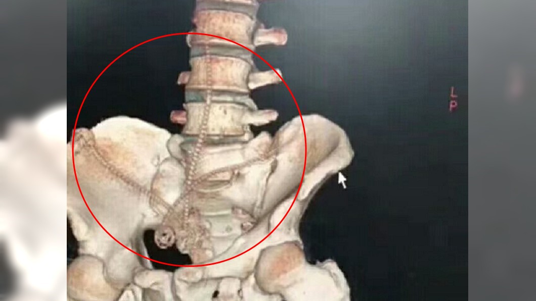 圖/翻攝自肝膽外科羅大夫微博