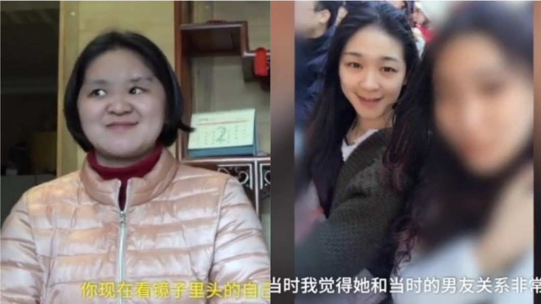 正妹空姐墜樓後,面部嚴重毀容。圖/翻攝自《微博》