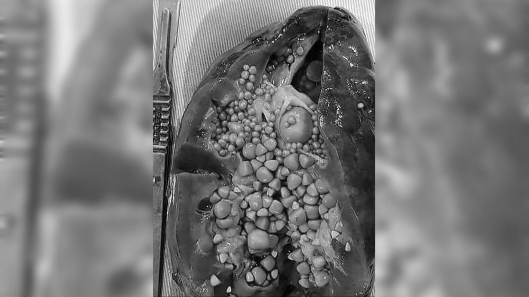 圖/翻攝自Medical-Online臉書