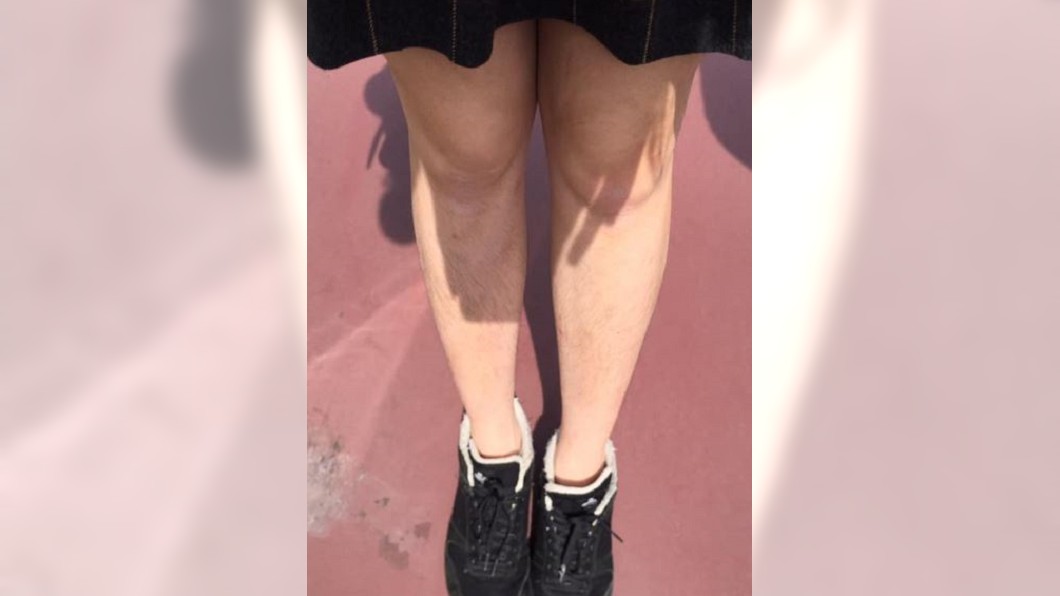 女子因腿毛被日本情侶嘲笑。圖／翻攝自爆怨公社