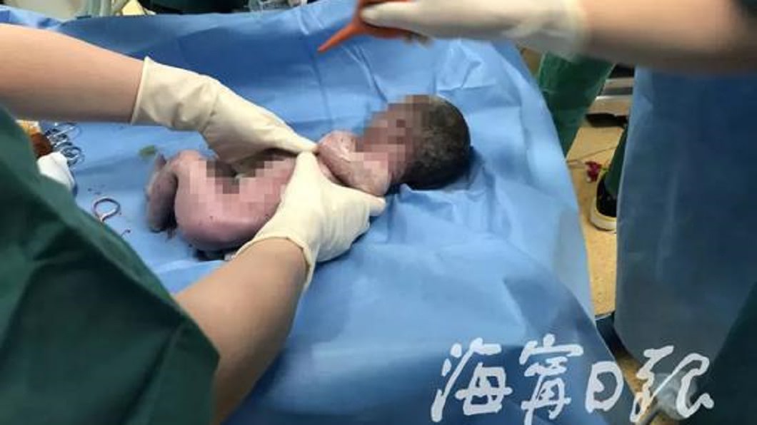 圖/翻攝自新浪網