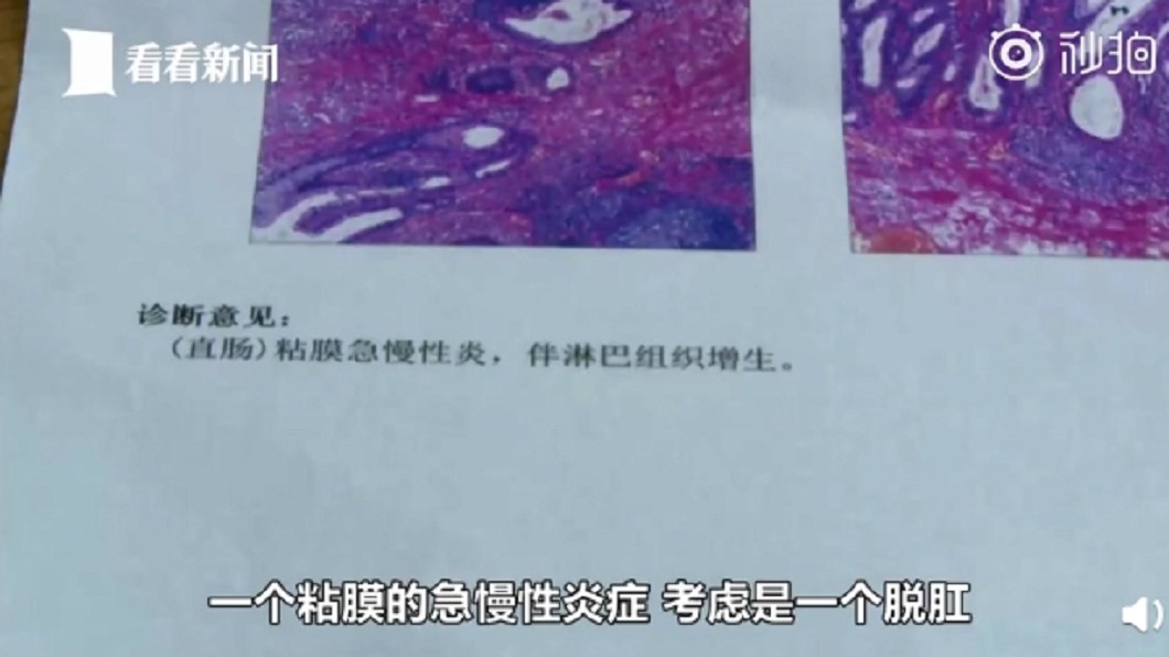 圖/翻攝自微博