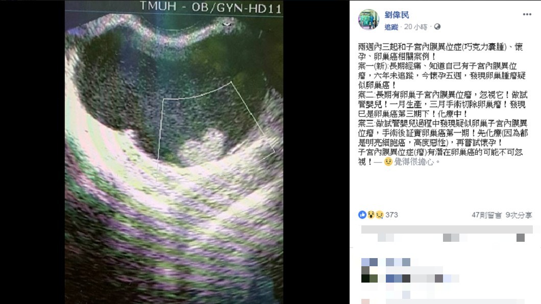 圖/翻攝自 臉書