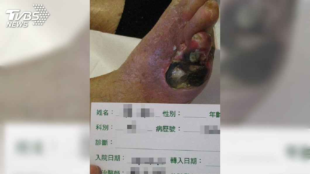 圖/亞洲大學附屬醫院 提供