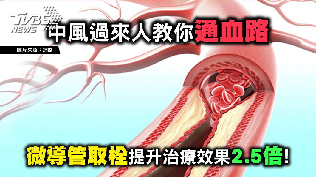 圖/TVBS提供 有「臨微不亂」症狀快就醫 中風也可以神復原！