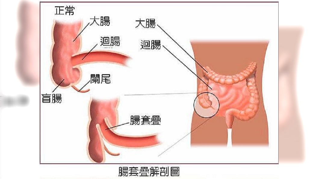 圖/臉書「來講兒科急診的543-吳昌騰醫師」授權使用