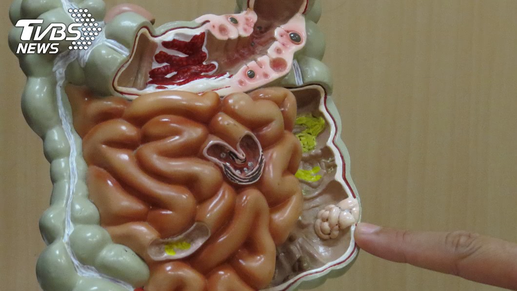 京都同仁堂 便秘3年...大腸竟藏百顆瘜肉 醫：這是「恐怖遺傳」