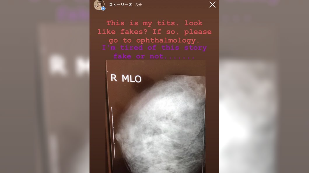 圖/翻攝自official_hitomitanaka的IG