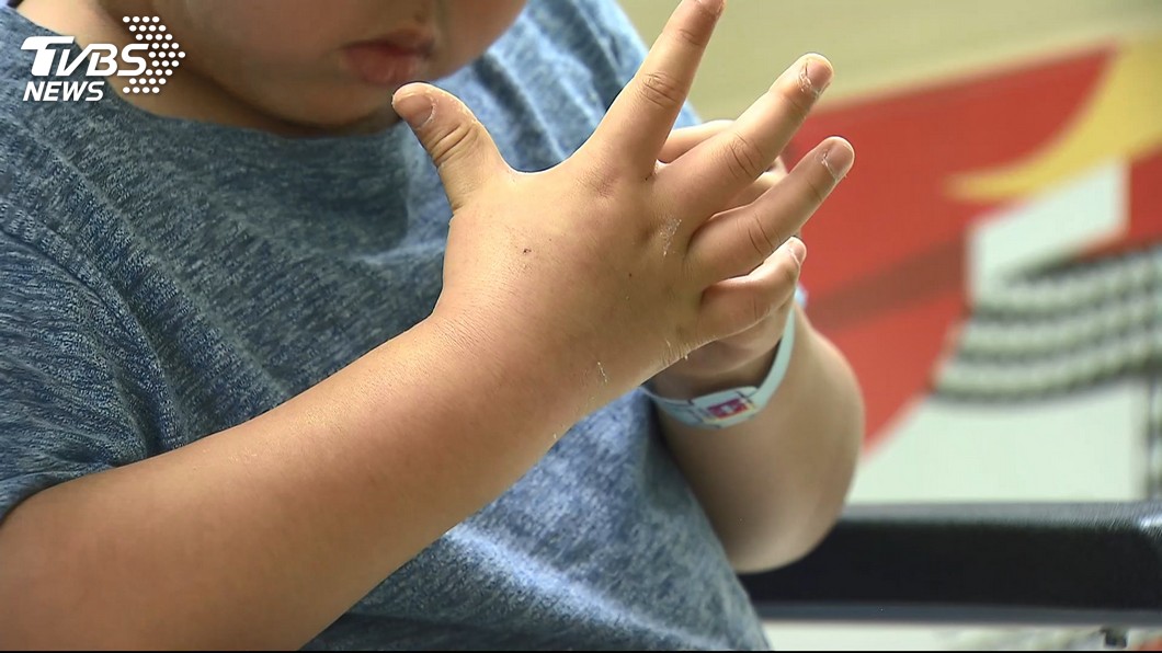家長憂 過動 找上兒 門診 爆號 諮詢過半 過動兒 疾病 幼童 教育 Tvbs新聞網