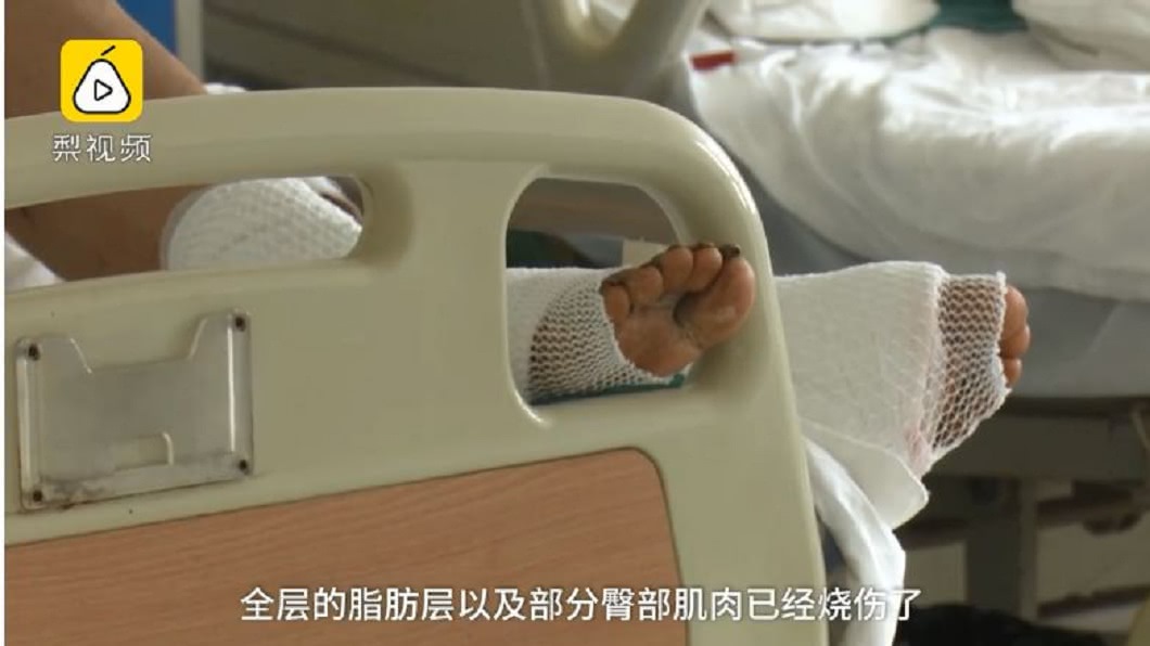醫師說明女子的傷勢。(圖/翻攝自梨視頻)