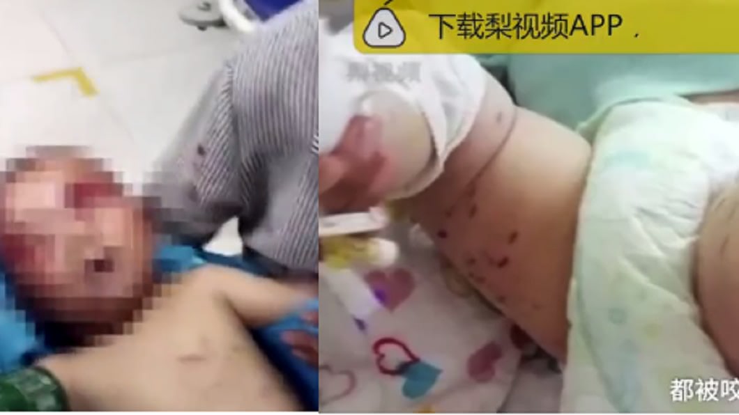 歲男童趁家人不注意,獨自跑到屋外,卻遭5隻流浪狗撕咬攻擊。圖/翻攝自人民網微博影片
