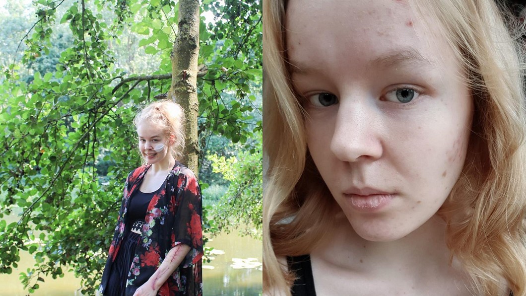 圖/翻攝自 Noa Pothoven 臉書
