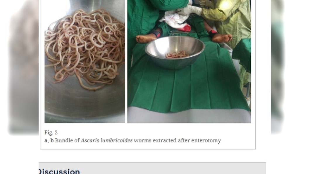 圖/翻攝自Journal of Medical Case Reports