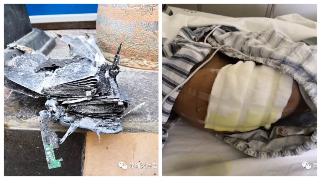 該款行動電源爆炸,導致外送員的大腿二級燒燙傷。(圖/翻攝自騰訊網)