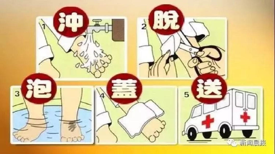 醫師提醒,燙傷發生時,一定要謹記沖脫泡蓋送的5字訣。(圖/翻攝自陸網)
