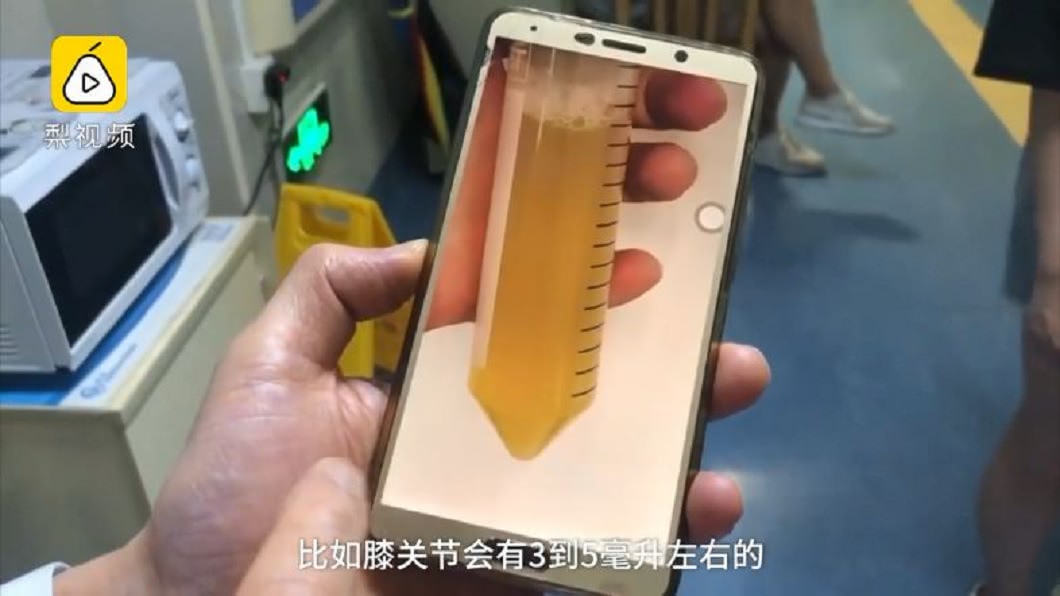 一般人正常的關節液呈現淡黃色。(圖/翻攝自梨視頻)