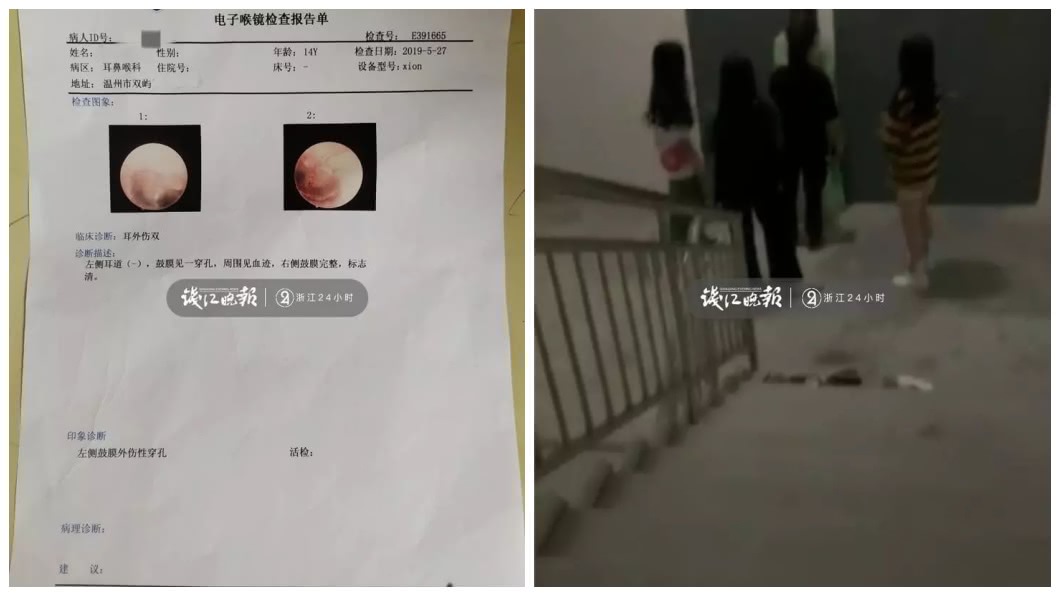 事後少女的母親得知此事帶女兒驗傷,並且報警提告。(圖/翻攝自錢江晚報)