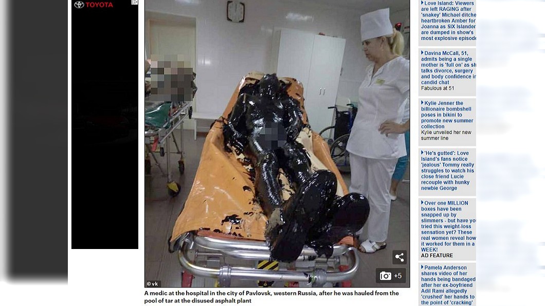 俄羅斯一名男子跌落瀝青池，緊急被送往醫院急救。(圖／翻攝自每日郵報)