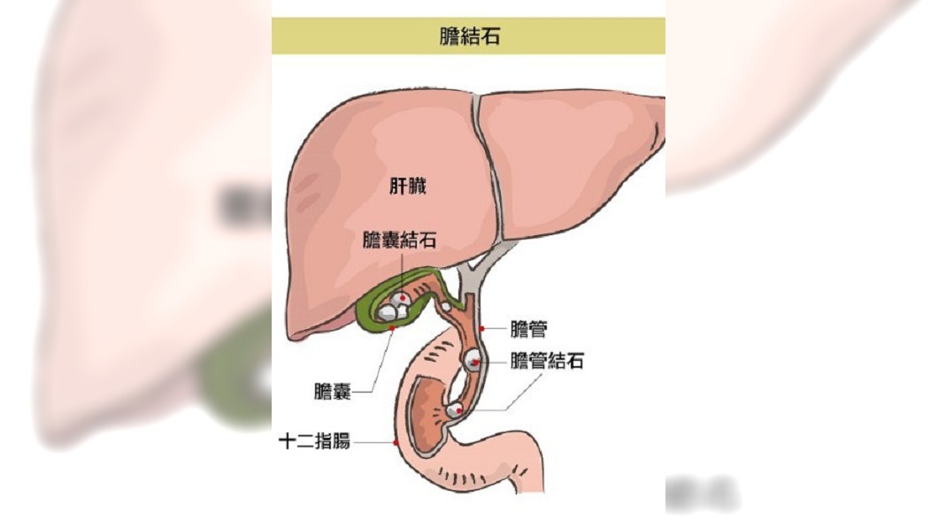 圖/康健雜誌提供