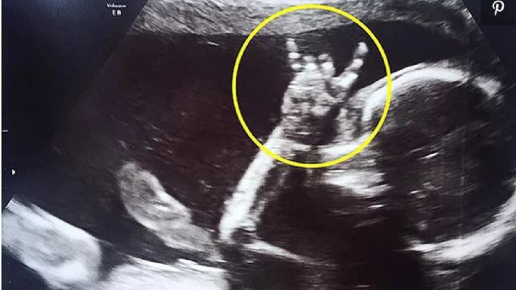 照超音波時發現寶寶比出rocker的手勢，父母親都超驚訝。(圖／翻攝自推特)