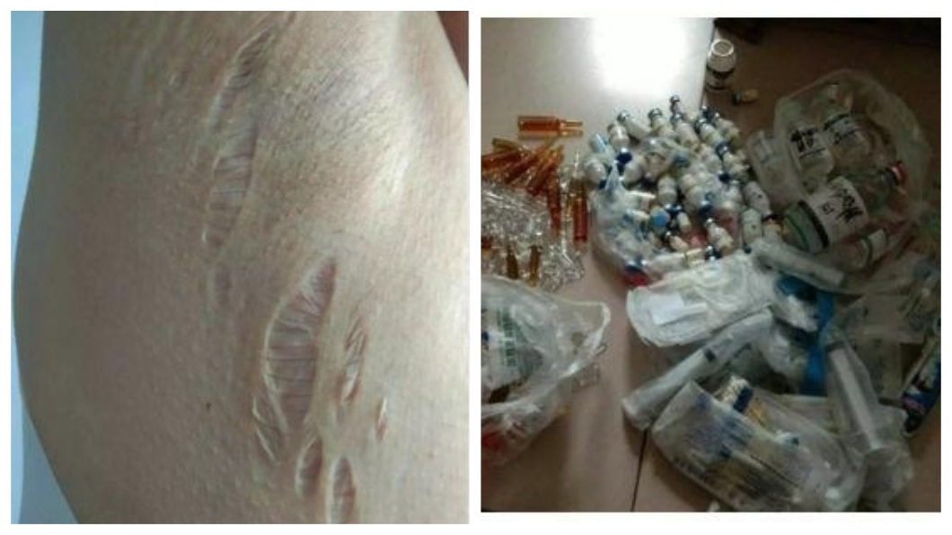 事後女子分享自己的身體出現狀況,家中還發現大量類固醇藥物。(圖/翻攝自陸網)