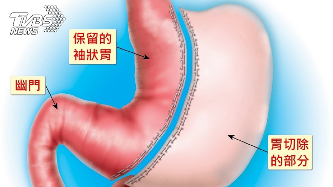 圖/慈濟醫院提供