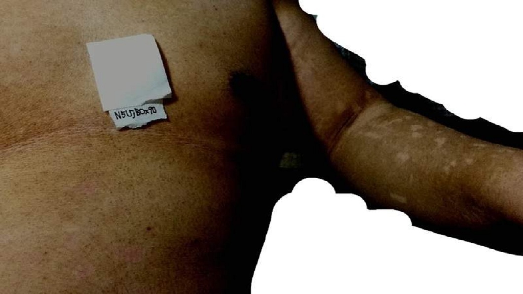 日本一名38歲男子自稱7年沒洗澡,全身都是陳年黑垢。(圖/翻攝自2ch論壇)