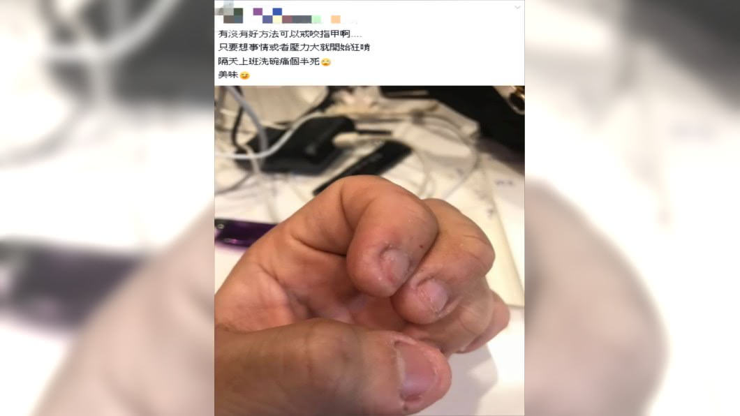 原PO壓力大的時候會咬指甲。圖/翻攝自爆怨公社臉書