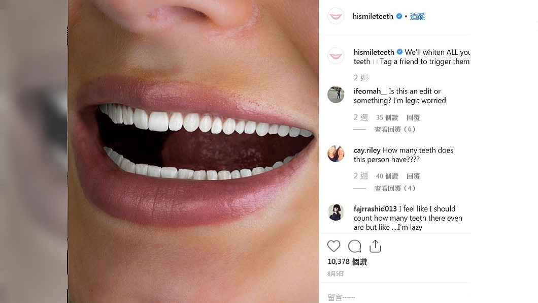 令人密集恐懼症發作的牙齒美白廣告。圖/翻攝Hismileteeth IG