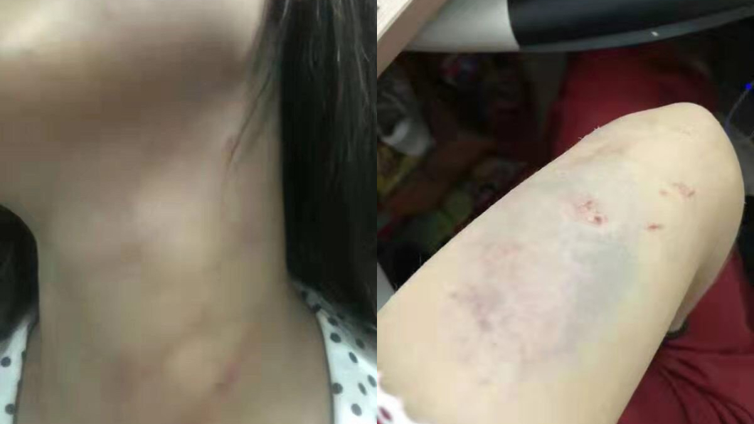 何女生前經常遭到丈夫家暴。圖/翻攝自巴中新曝料微博