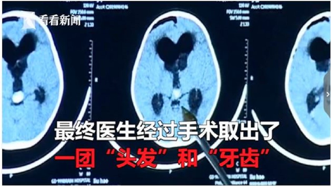 圖/翻攝自看看新聞影片
