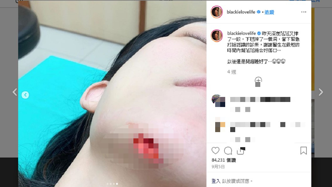 黑人上月初發布一張愛妻的下巴特寫照。 圖/翻攝自黑人IG