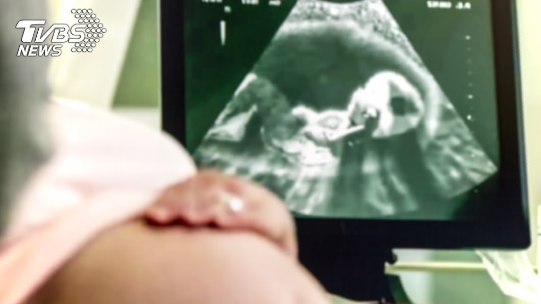 示意圖／TVBS 懷孕驚見「外面還有1胎」　醫取出：2個都軟綿綿