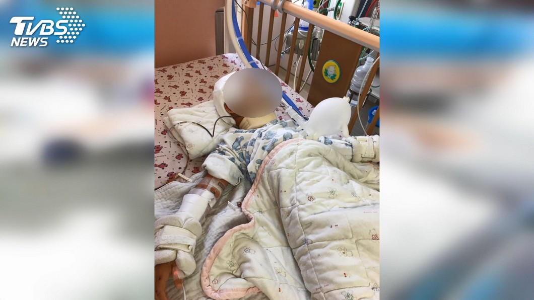 圖／TVBS 國道兩度被撞甩車底　7歲女童命危恐截肢