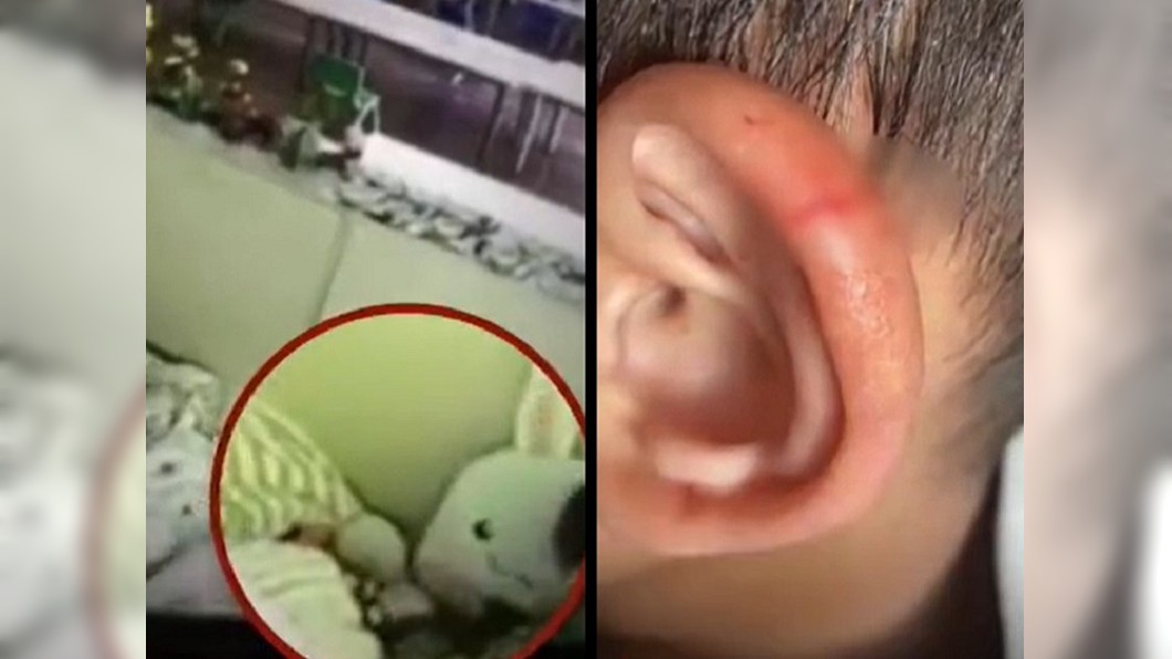 中國大陸5歲男童不肯午睡，卻被老師用剪刀剪耳朵。(圖/翻攝自秒拍)