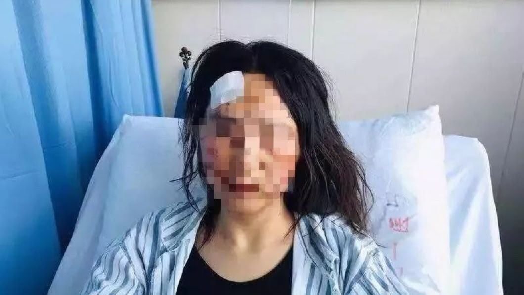 浙江溫州1名女子遭丈夫和公公聯手家暴圍毆，被打得遍體鱗傷。(圖／翻攝自微博)