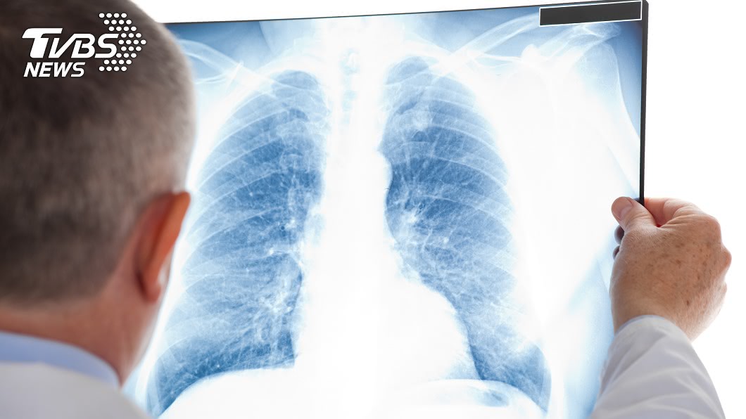 新冠肺炎即便痊癒，仍有可能「肺部纖維化」。(示意圖／TVBS)