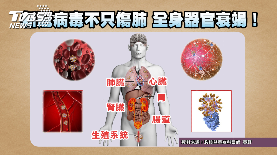 圖/TVBS提供