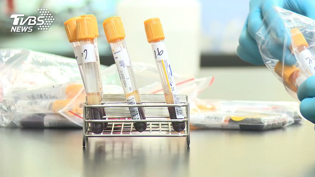 台大公共衛生學院將和彰化縣衛生局合作進行萬人血清抗體檢測。（圖／TVBS資料畫面）