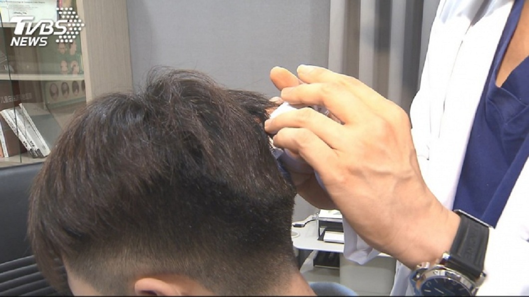 不少男性都面臨髮際線退後的問題，擔心恐有禿頭危機。（示意圖／TVBS）
