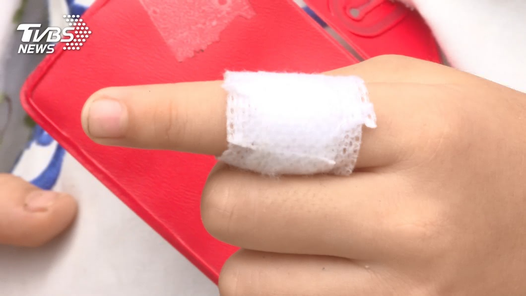 圖／TVBS 卡住了！塑膠環套5歲童手指　園長急奔警所