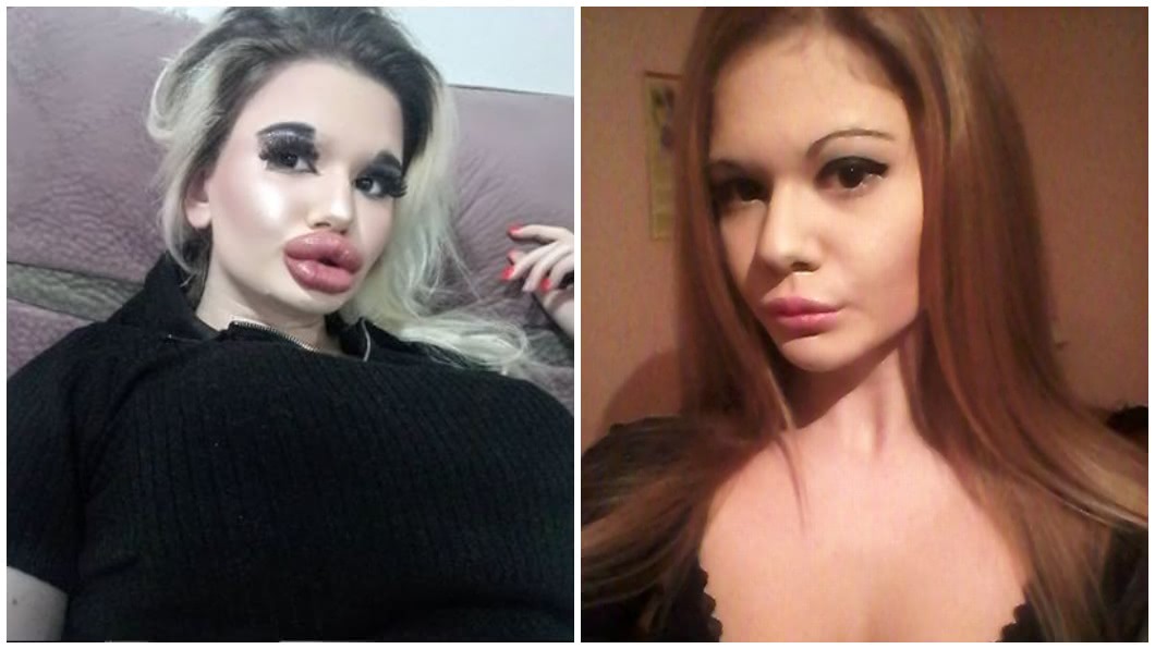 保加利亞一名女大生，期許自己擁有世界最大嘴唇，至今已經打了21次玻尿酸。（圖／翻攝自IG）