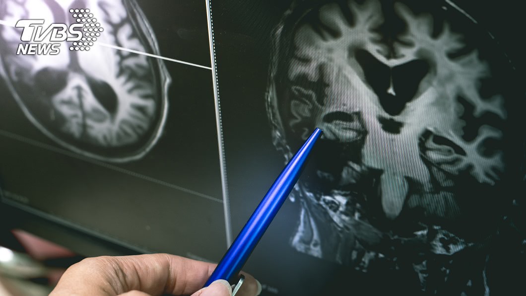 孩童的腦卻像極了80歲老人。(示意圖/shutterstock達志影像) 遭虐全身傷!高雄3歲童「腦萎縮成80歲」 父母不養了